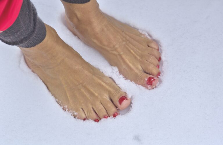 5 consejos cuidar pies invierno