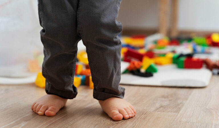 pies planos en niños