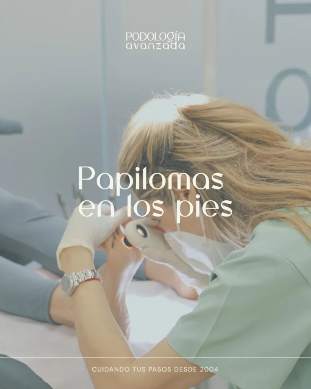 🚫 Evita los papilomas en los pies 👣
Los papilomas, también conocidos como verrugas plantares, son causados por el virus del papiloma humano (VPH) y pueden aparecer en la planta de los pies, provocando molestias o dolor. 🦠
👉 Consejos para prevenirlos:
✅ Usa sandalias en piscinas y duchas públicas.
✅ Seca bien tus pies después de bañarte.
✅ No compartas calzado ni toallas con otras personas.
💡 Si notas verrugas o molestias al caminar, ¡no lo ignores! Cuidar tus pies es cuidar tu salud. 🌟
📞 971 372 299
📩 podologiavanzada@gmail.com
#PodologíaMallorca #SaludPodal #CuidadoDeLosPies #PodologíaAvanzada
#PiesSanos #PodólogoMallorca #BienestarPodal #PodologíaDeportiva
#SaludYBienestar #MallorcaSalud #Biomecánica #PodologíaInfantil #PiesNiños #Podologos #PodologiaEspaña #SaludDeportiva